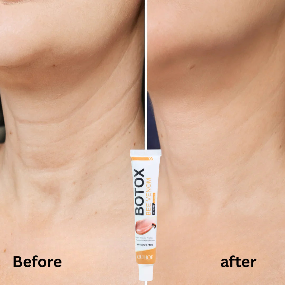 Botox Bee Venom Wrinkle Removal & Firming, Moisturizing, Anti-Aging, Lifting & Recovery for All Skin Type.
