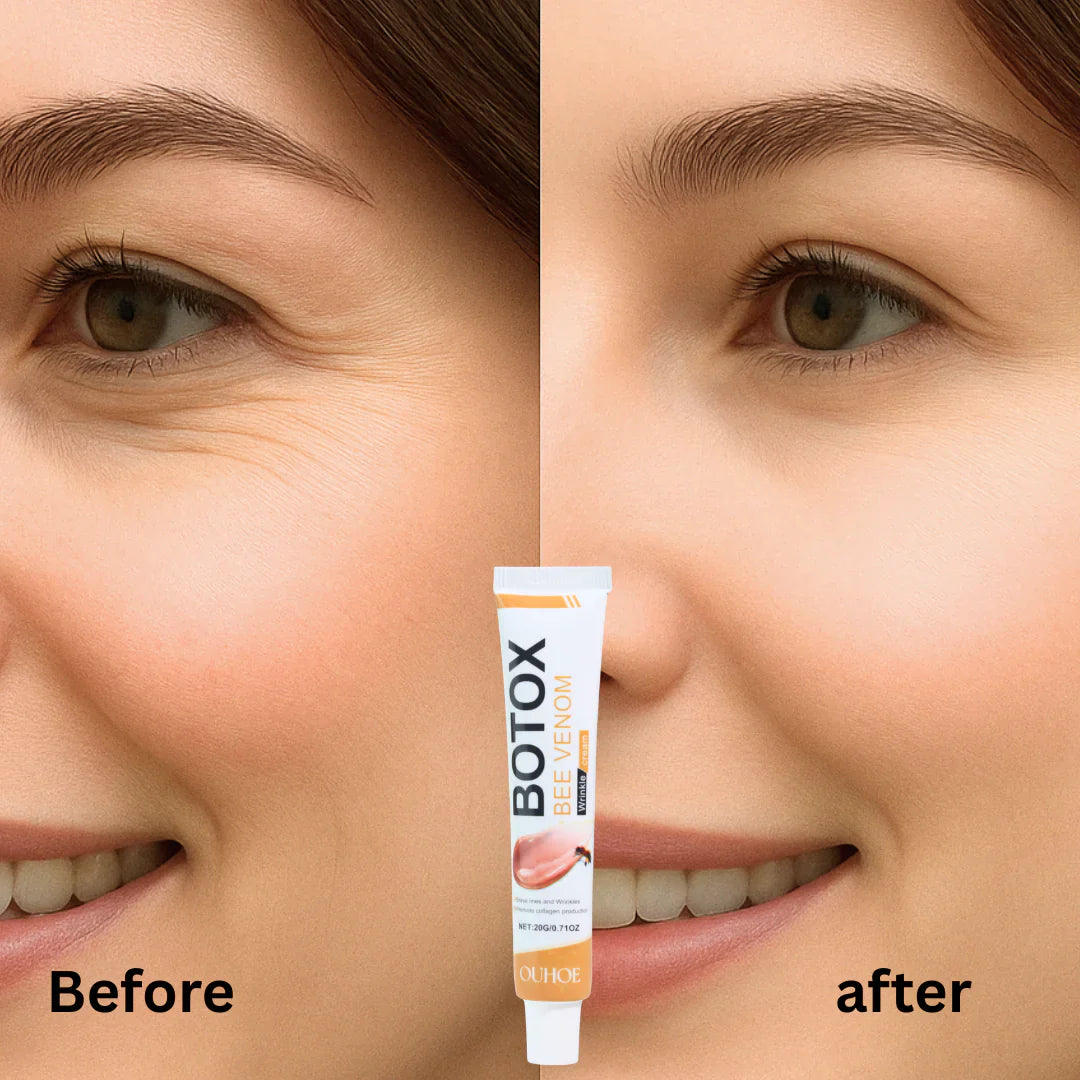 Botox Bee Venom Wrinkle Removal & Firming, Moisturizing, Anti-Aging, Lifting & Recovery for All Skin Type.