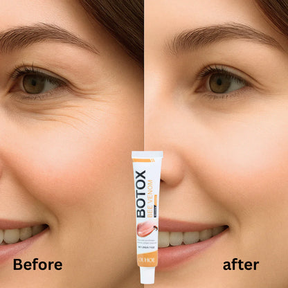 Botox Bee Venom Wrinkle Removal & Firming, Moisturizing, Anti-Aging, Lifting & Recovery for All Skin Type.